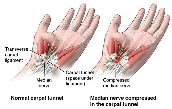 carpal-tunnel-diagram