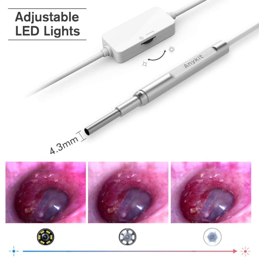 Anykit USB耳镜-耳镜摄像头